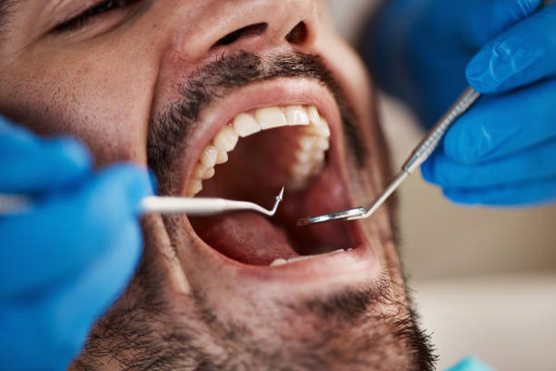 Best Cracked Tooth Emergency Dentist  in West Perrine, FL